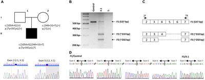 Identification and Characterization of Known Biallelic Mutations in the IFT27 (BBS19) Gene in a Novel Family With Bardet-Biedl Syndrome